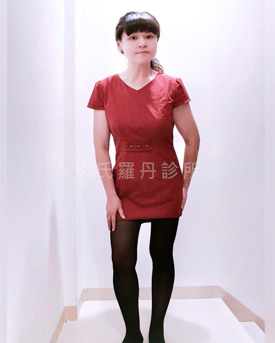 減脂 減肥 減重