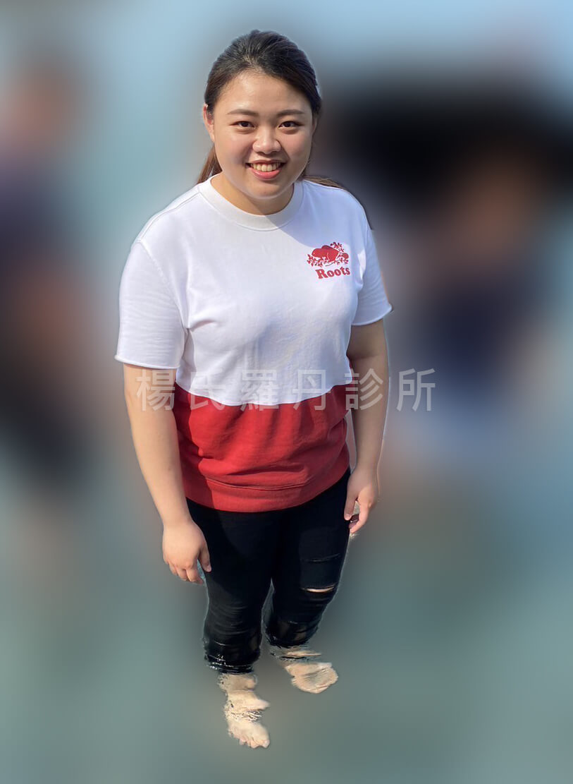 減肥 瘦身 減重