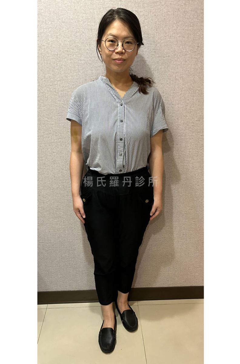 減肥 減重 減脂