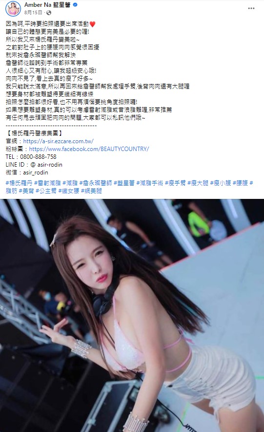 藍星蕾 抽脂 瘦手臂 瘦大腿