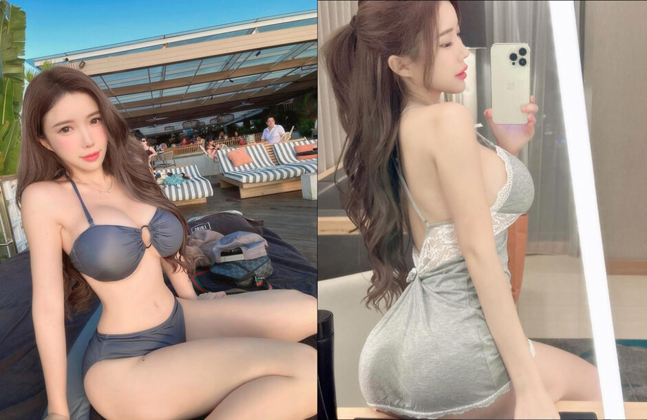 抽脂 藍星蕾 手臂抽脂