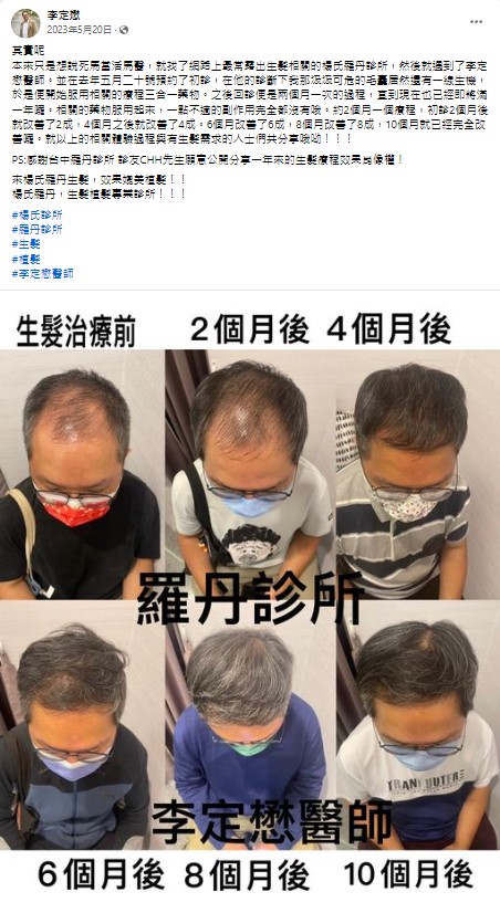 生髮 生髮療程 植髮 