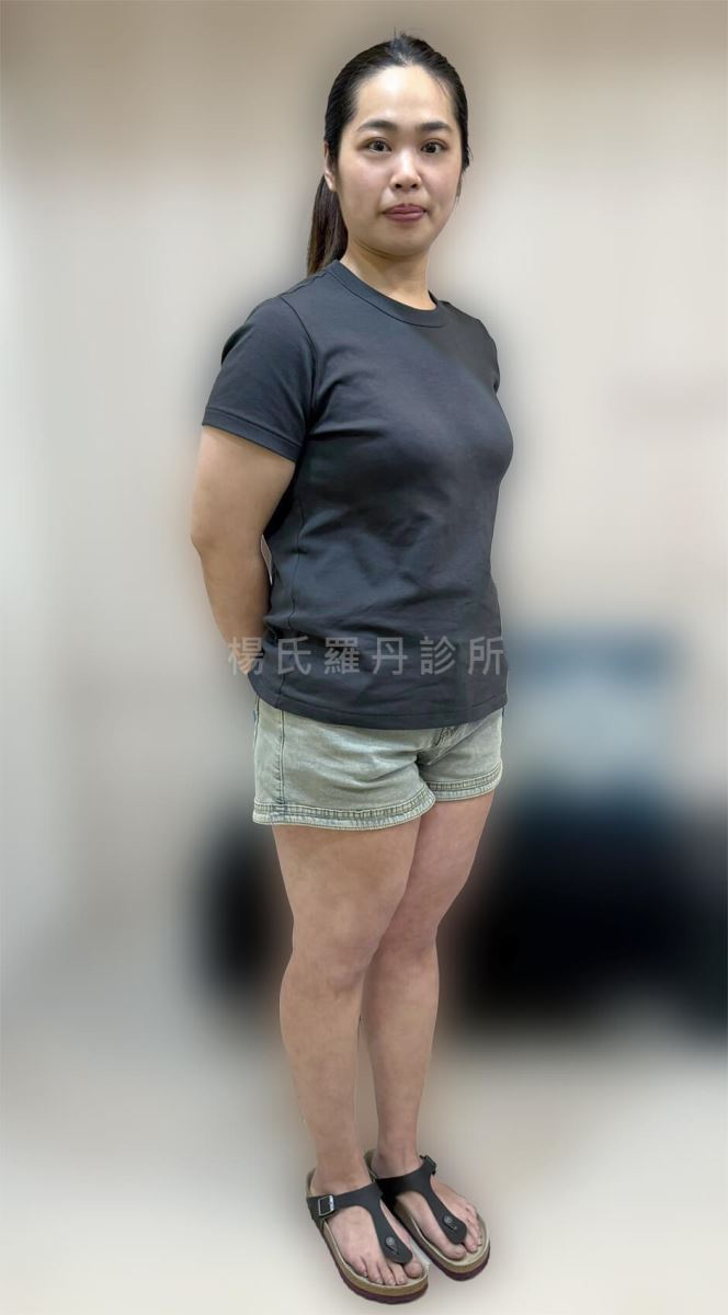 減重 減重成功 瘦身