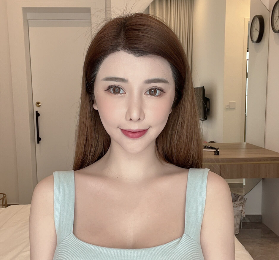 美型植髮 周甄娜