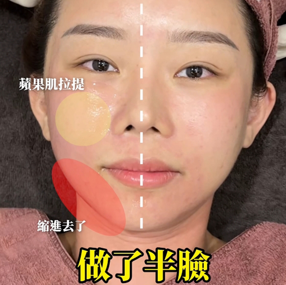 廢力西亞 鳳凰電波