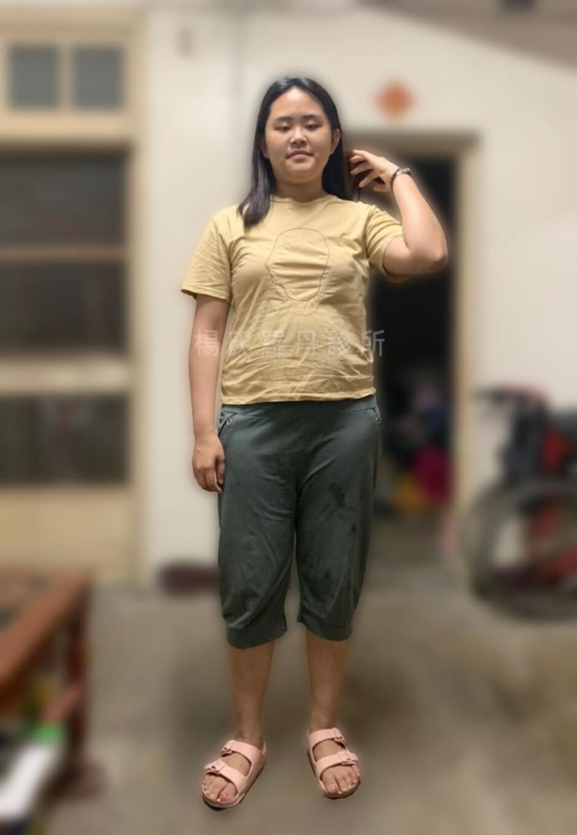 減重 減肥