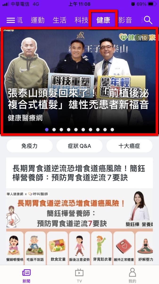 張泰山 掉髮 前植後泌