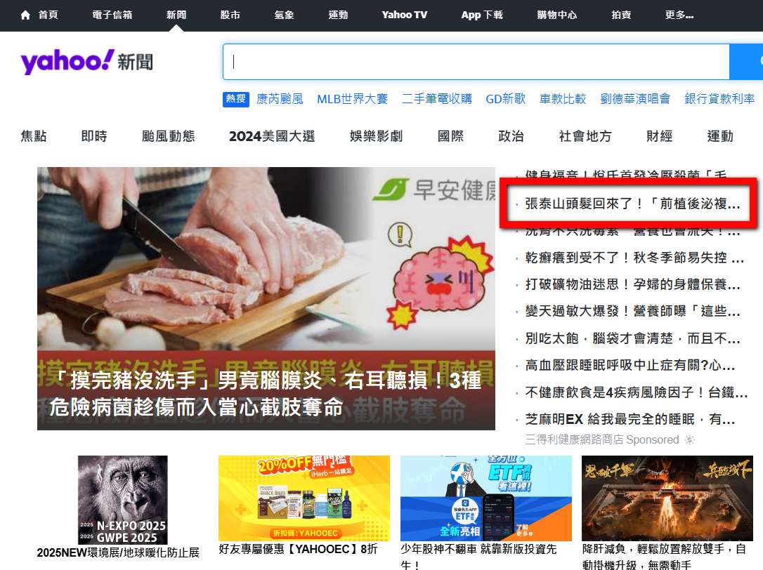 張泰山 頭髮 雄性禿