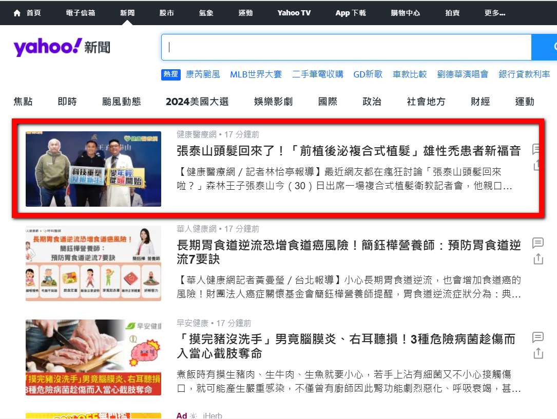 張泰山 頭髮 掉髮