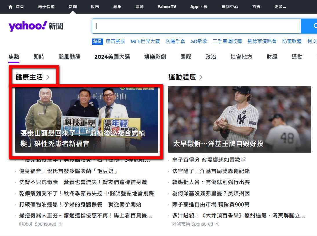 張泰山 頭髮 植髮 掉髮