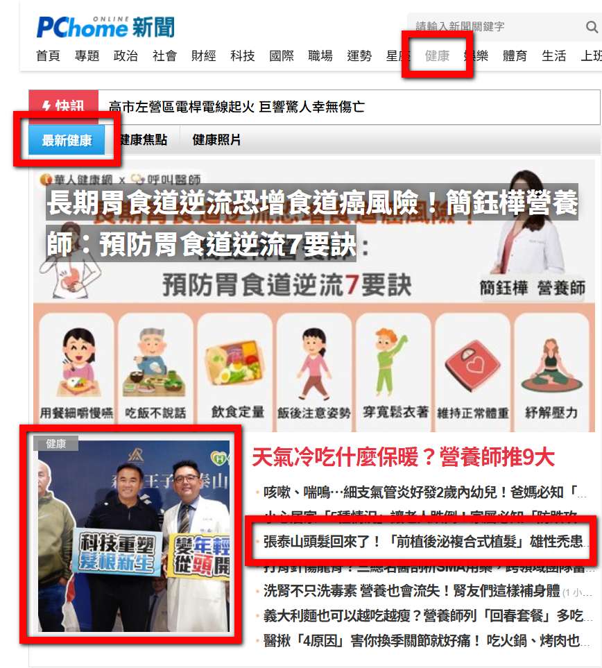 張泰山 前植後泌 頭髮