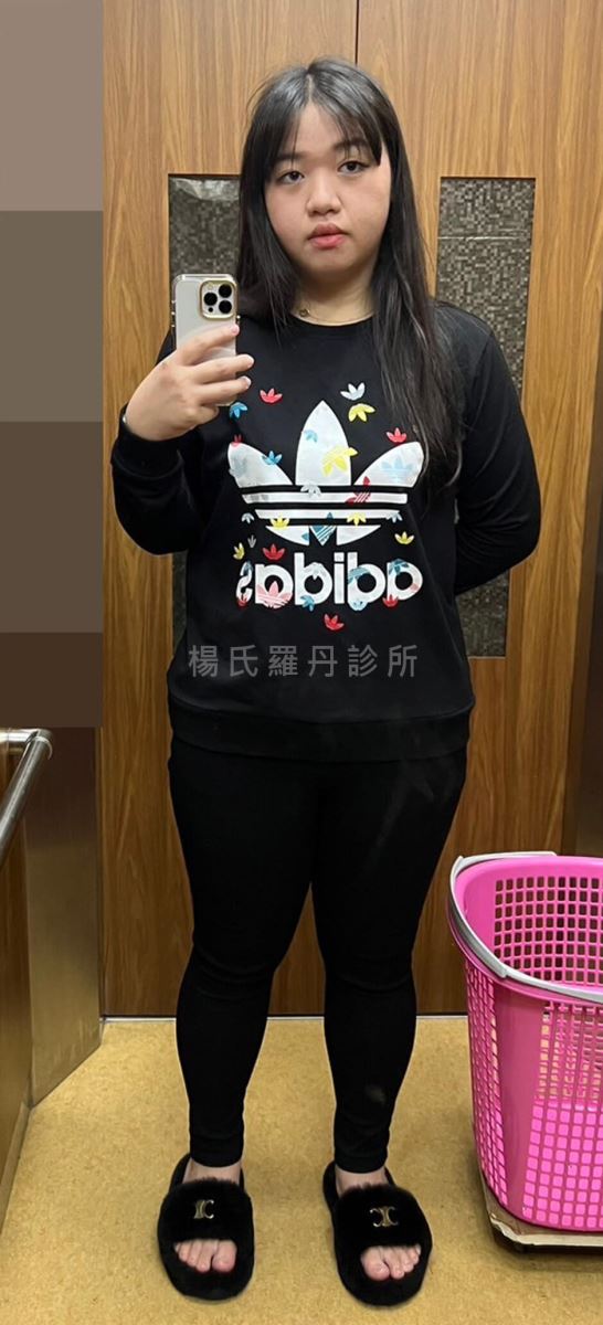 減肥 減重