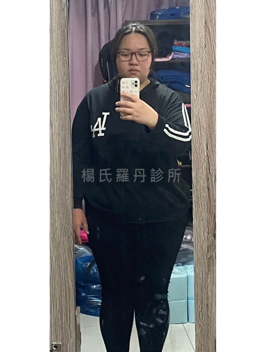 減重 減肥