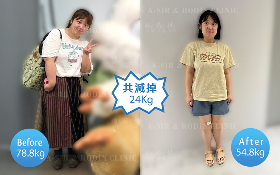 減重 減肥 減重成功