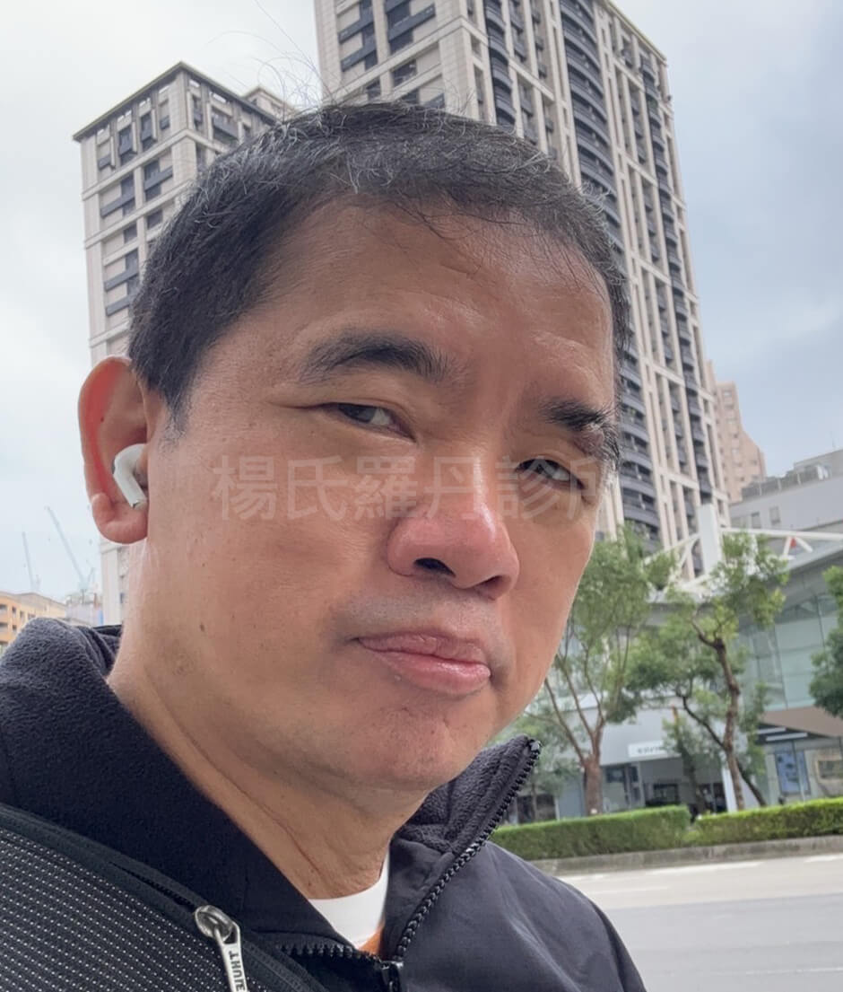 外泌體 育髮療程