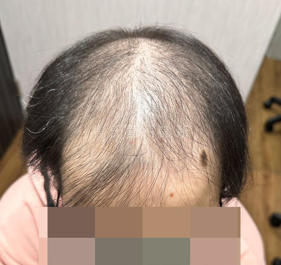 生髮 生髮效果