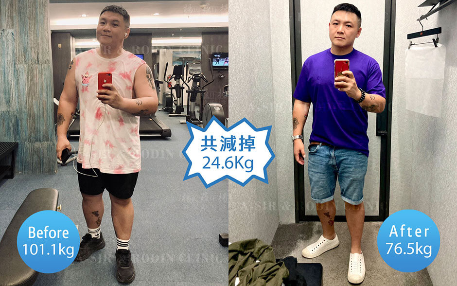 減重 減肥 減重成功
