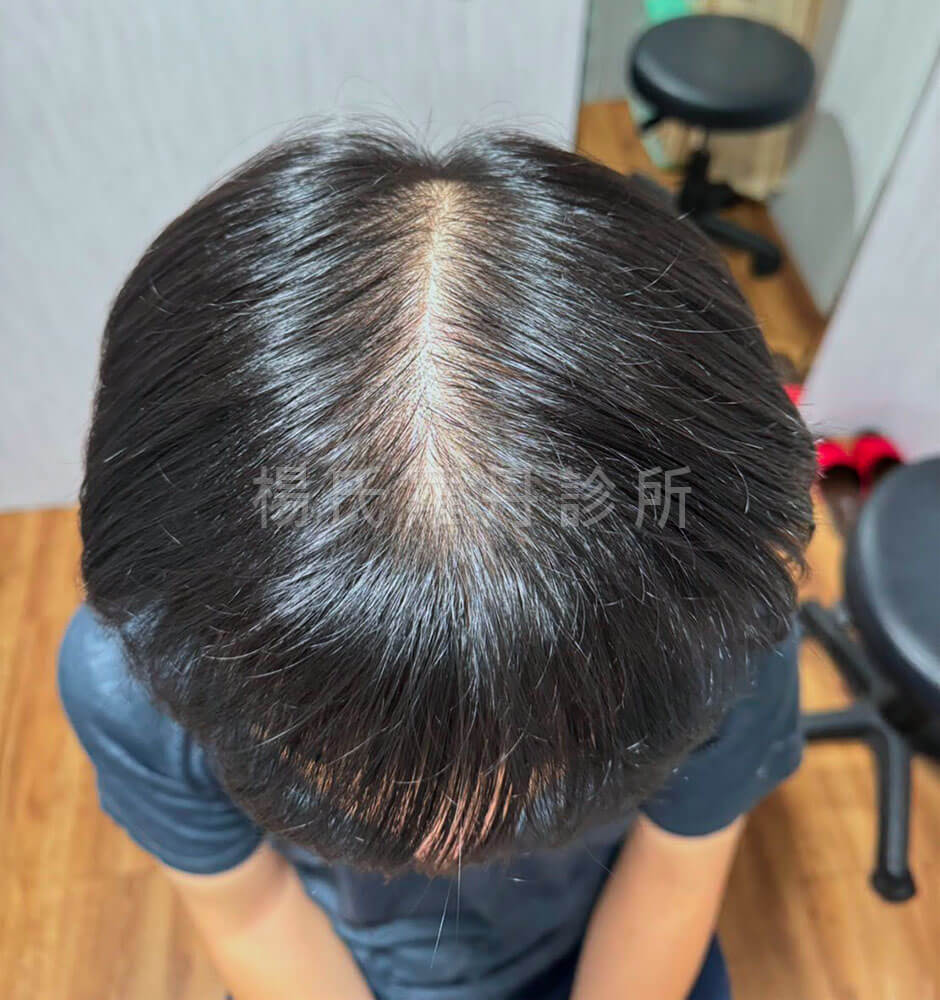 生髮 生髮效果