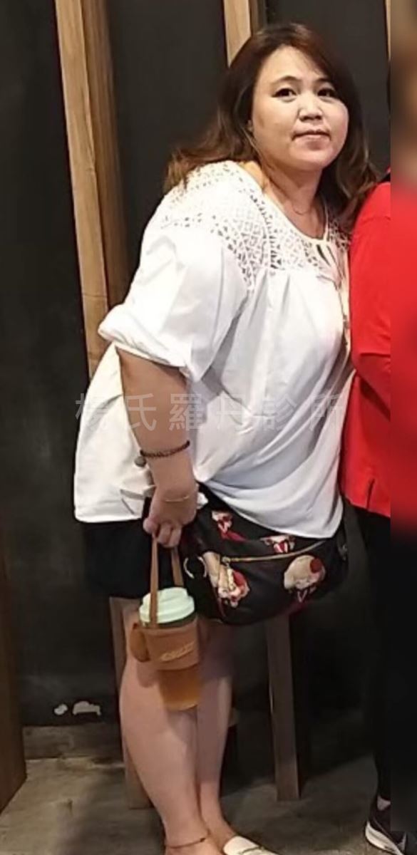 減肥 減重