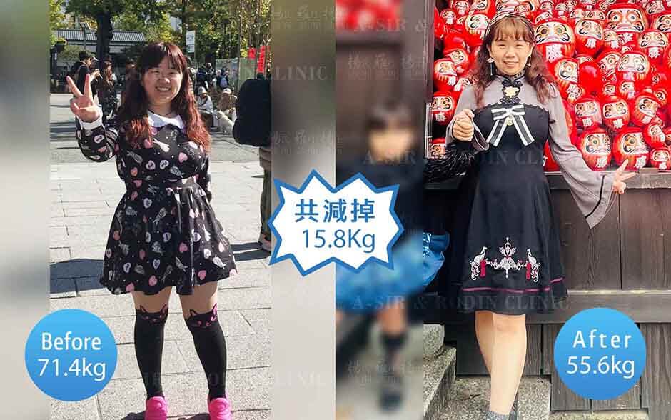 減重 減肥 瘦身