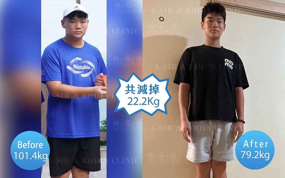 減重 瘦瘦筆 減肥