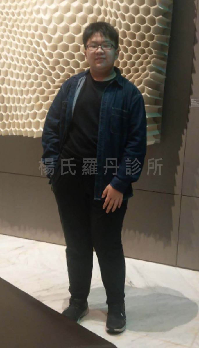 減重 減肥
