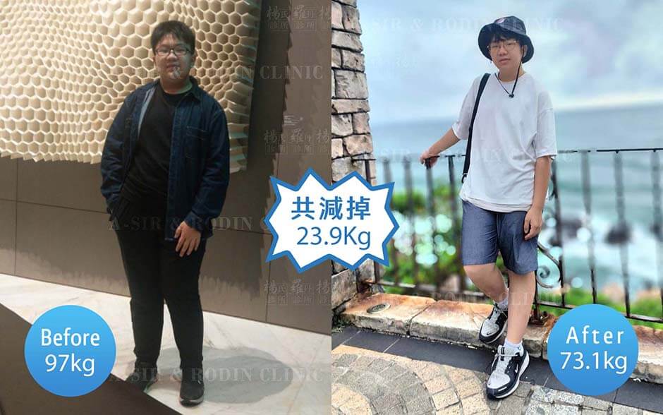 減重 瘦瘦筆 減肥