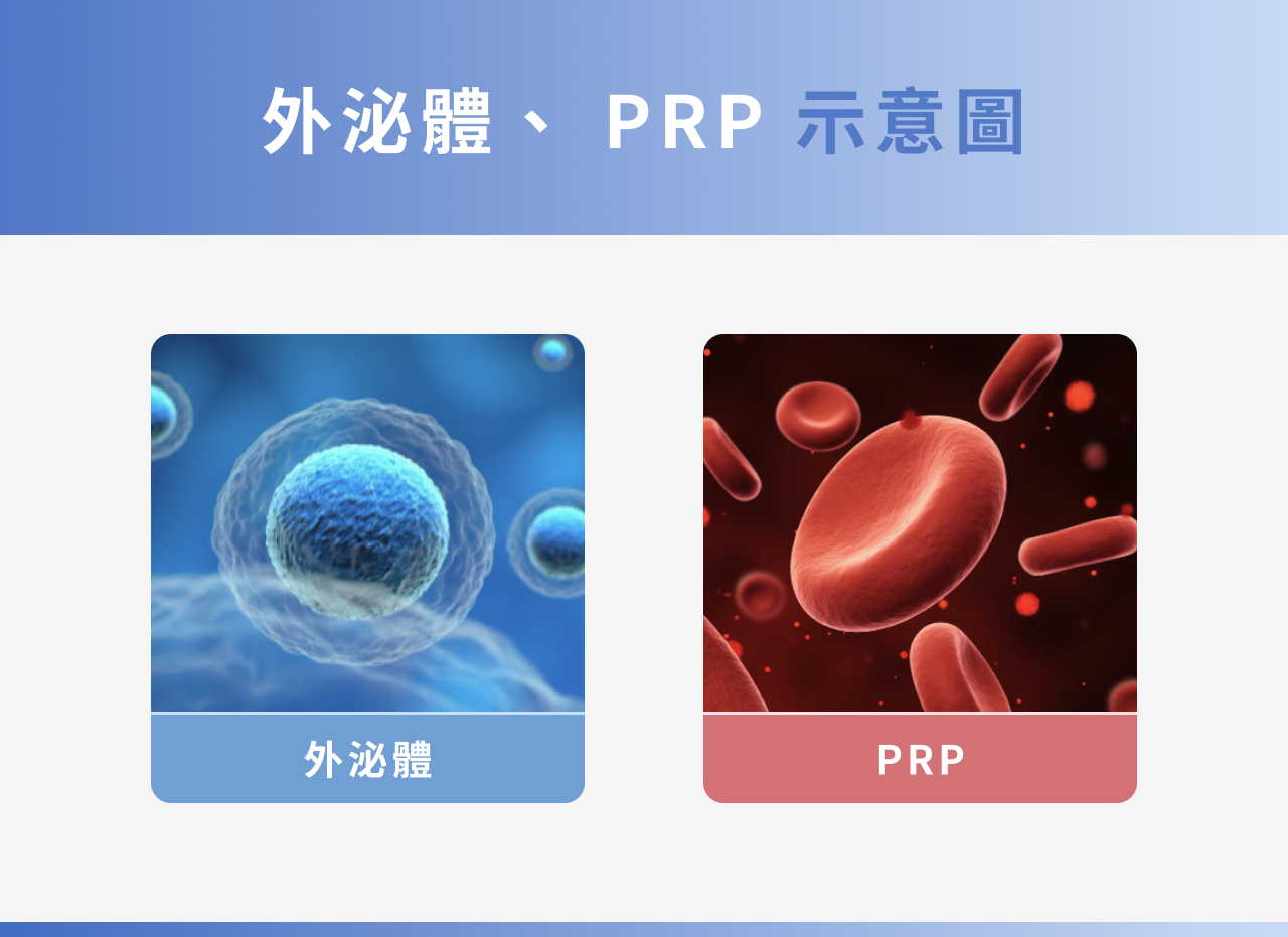 外泌體、 PRP 示意圖