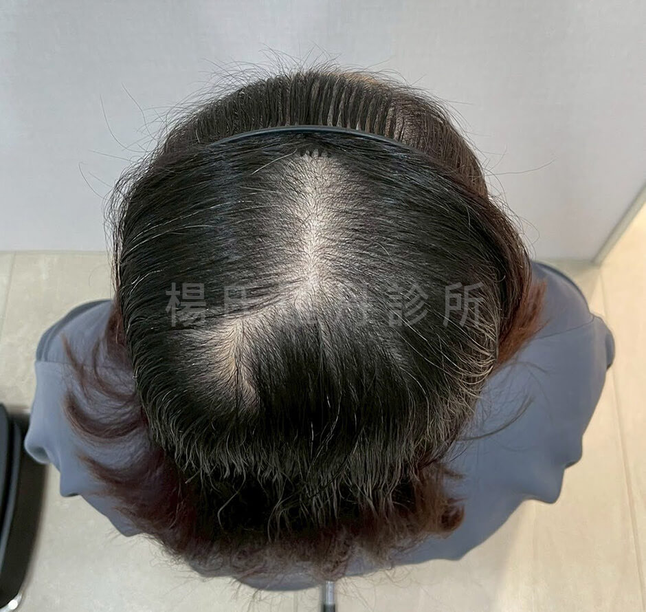 生髮 生髮成果