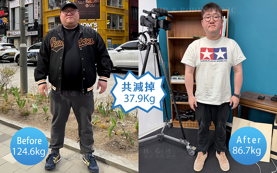 減肥 減重 瘦身