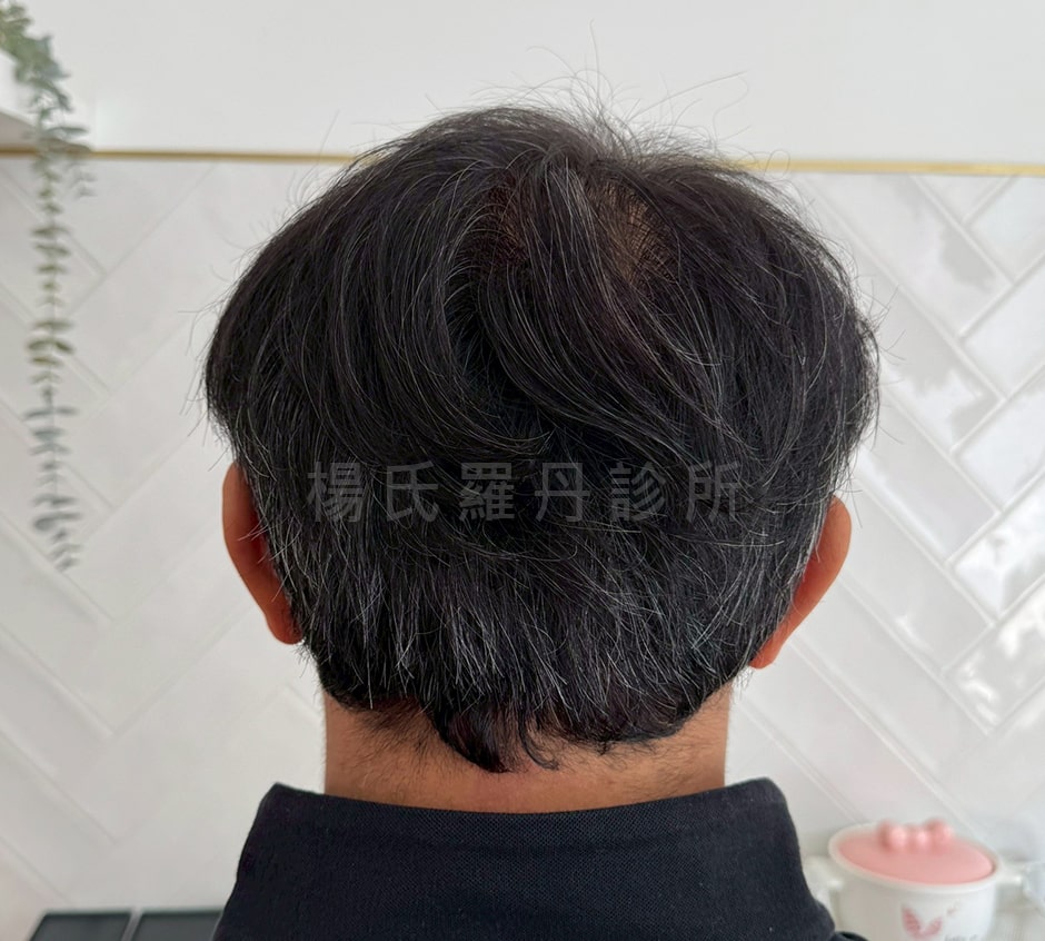 張泰山 張泰山的頭髮