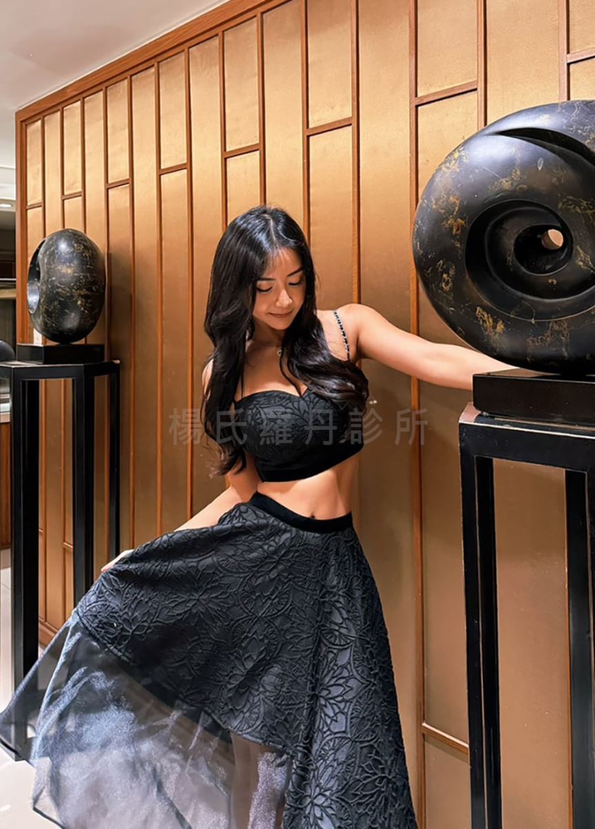 言言 髮際線植髮