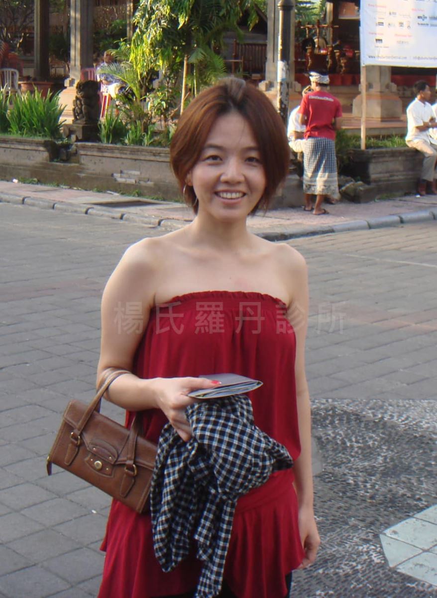 手臂抽脂術前 雷射減脂