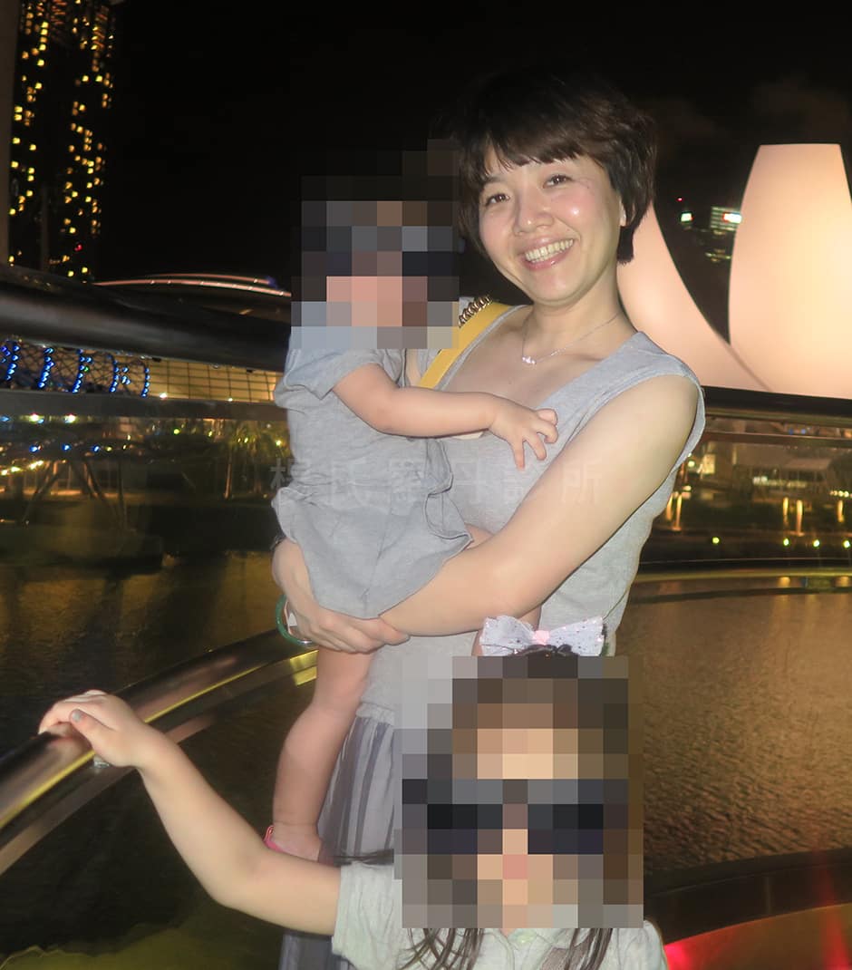 手臂抽脂術後生完二胎纖細