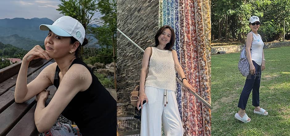 手臂雷射減脂術後16年輕盈纖細