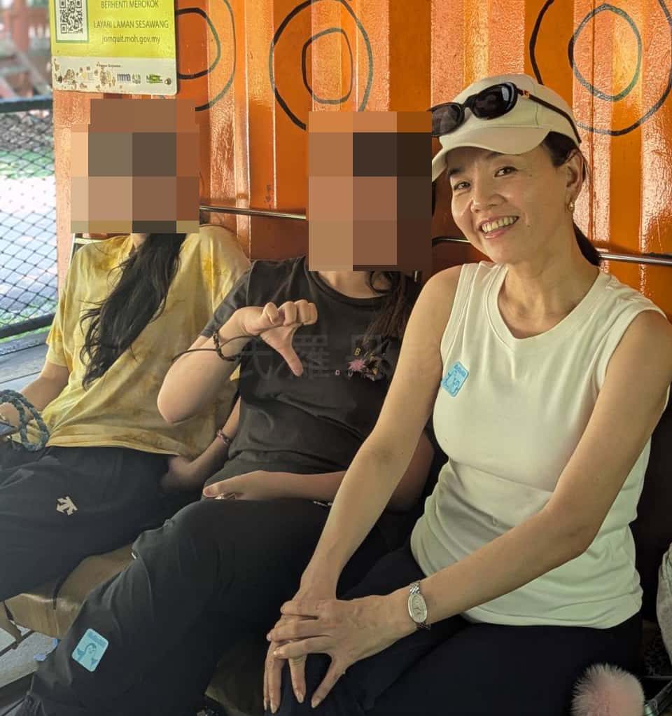 雷射減脂術後手臂纖細生活照