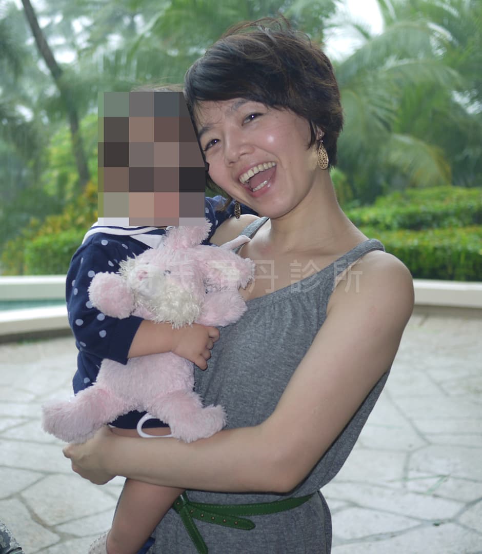 雷射減脂產後瘦手臂有感