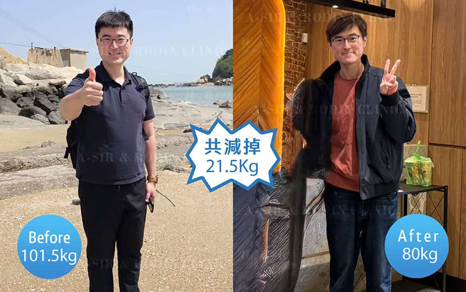 男性減重案例前後對比照