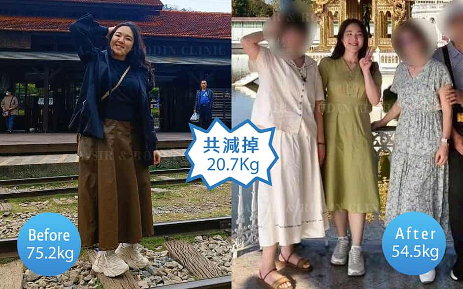 減重診所推薦減重1年3個月對比圖
