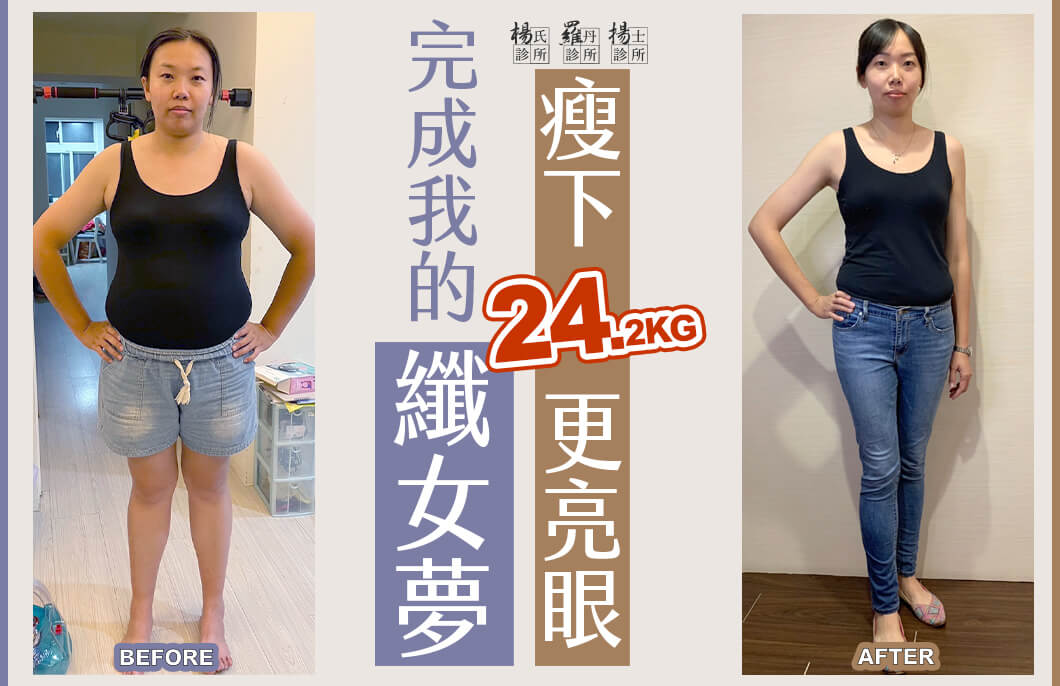 【減肥減重】完成我的纖女夢，瘦下24.2公斤更亮眼
