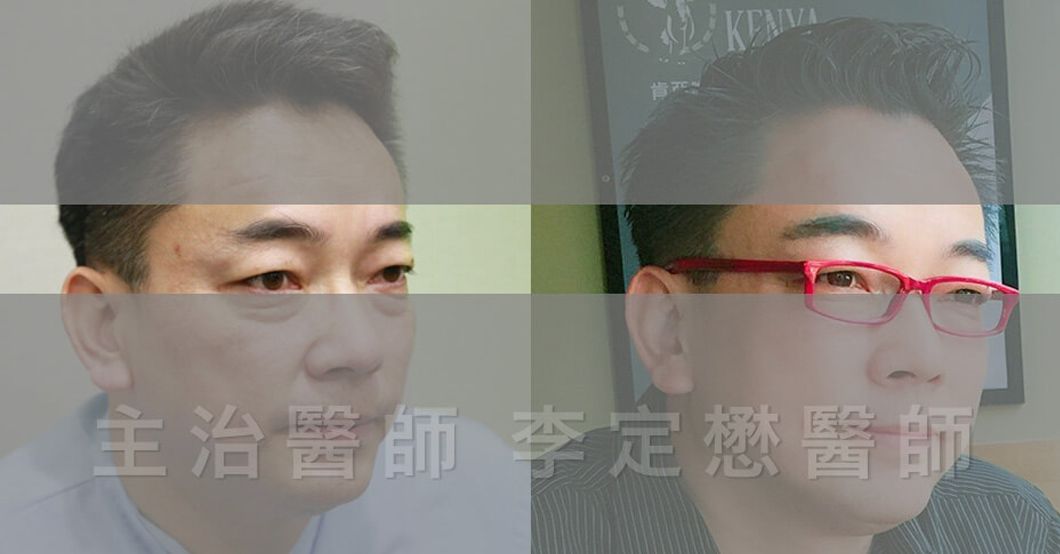 詹惟中眉短無貴人 植眉後運勢大開人脈滾滾來