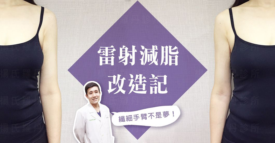 【雷射減脂】對自己的粗手臂心灰意冷  瘦手臂後找回自信