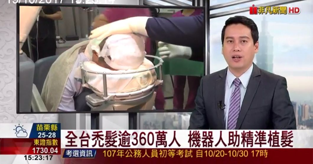 ARTAS植髮效率高　吸引韓籍醫訪台取經
