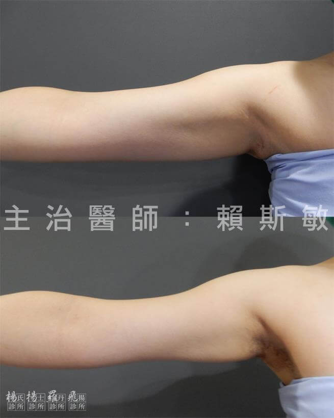 Y小姐：有時候 恭喜 也是一種羞辱