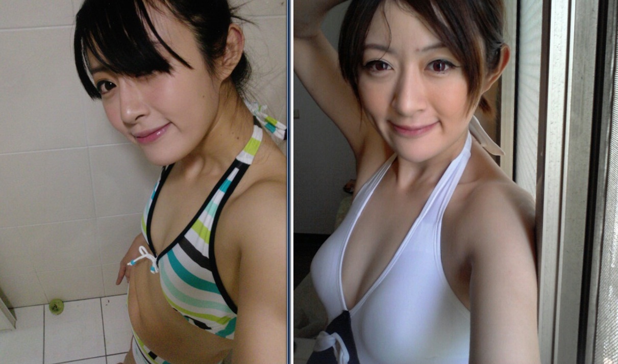 感情受挫變平胸!自體脂肪豐胸找回事業線