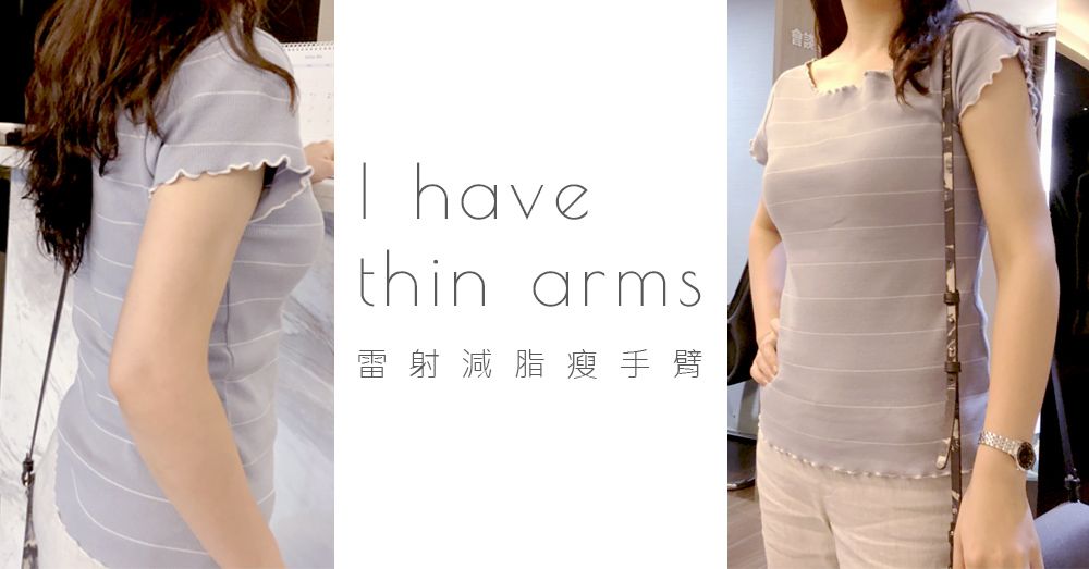 【雷射減脂】擁有跟IG網美一樣的纖細手臂！術後5個月心得