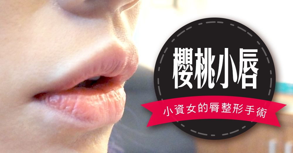 【台北‧縮唇(縮脣)手術】我有美美的唇珠了！香腸嘴變櫻桃小嘴♥術後半年心得分享