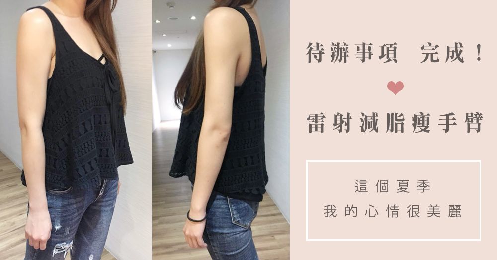 【台北‧雷射減脂瘦手臂】人生待辦事項：處理掉我的『粗壯手臂』