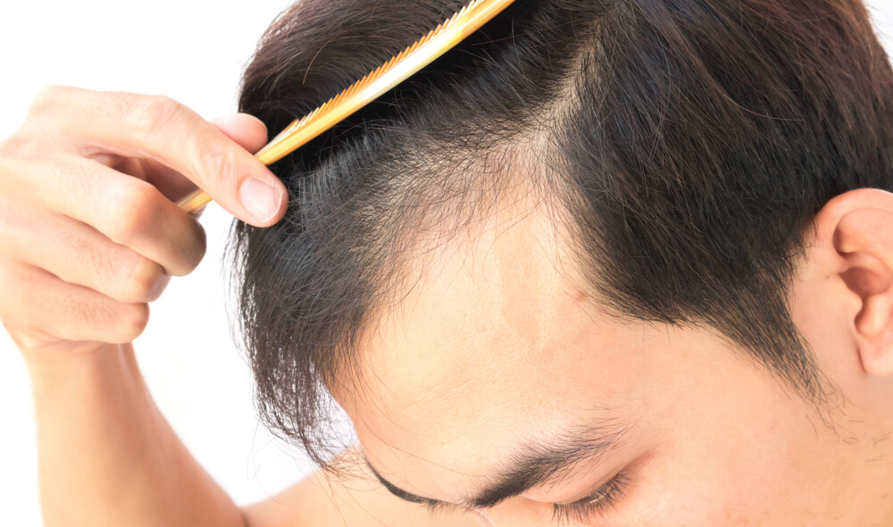 認識FUE植髮！一次了解手術流程、價格及術後照顧