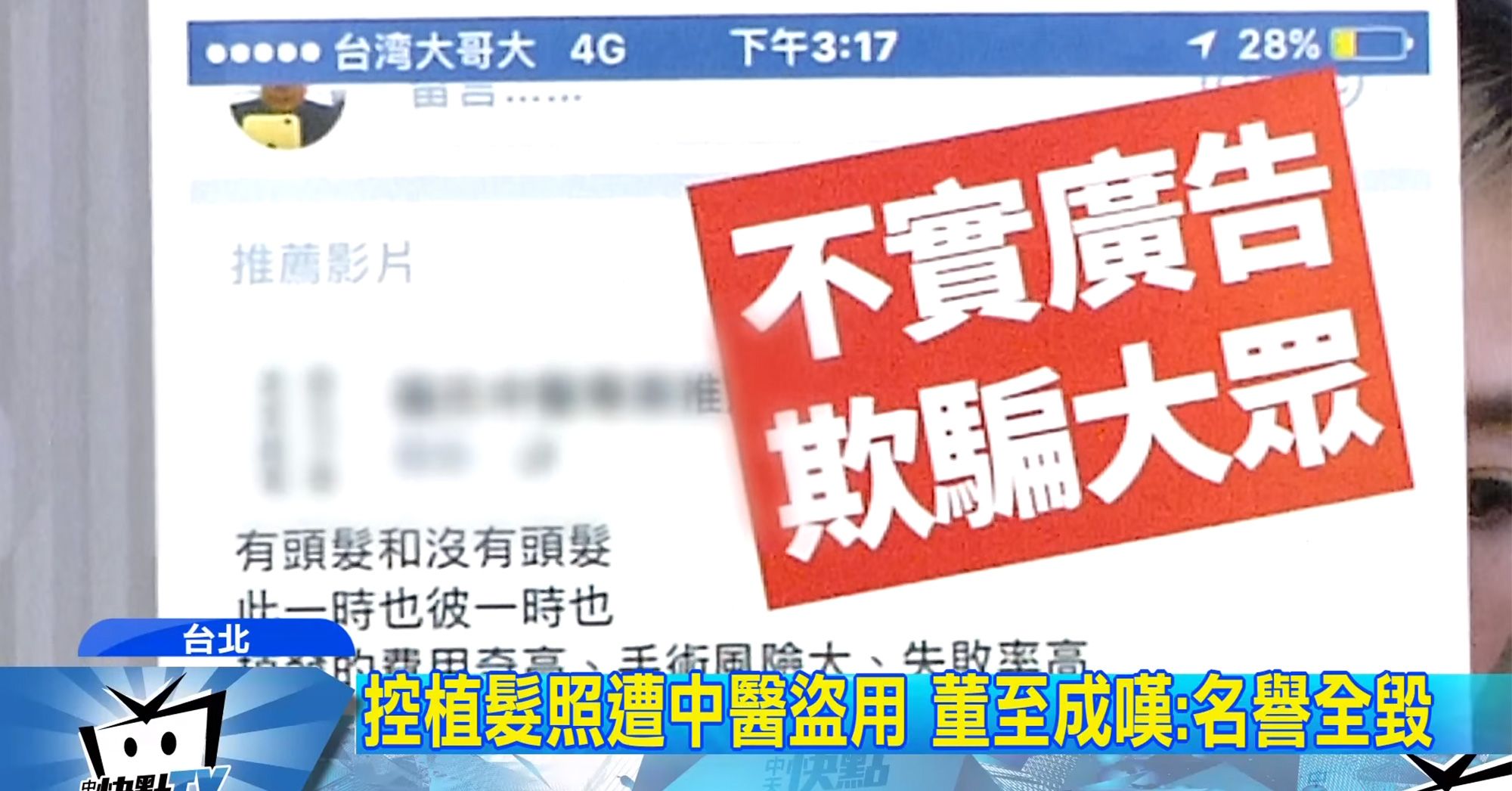 董至成控遭診所盜圖 消費者「洗到發炎」找嘸人
